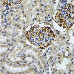 Anti-CETP antibody used in IHC (Paraffin sections) (IHC-P). GTX64582