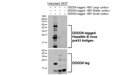 Anti-Hepatitis B virus preS1 antibody [HL5350] used in Western Blot (WB). GTX645828