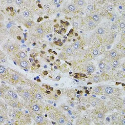 Anti-Bestrophin 1 antibody used in IHC (Paraffin sections) (IHC-P). GTX64583