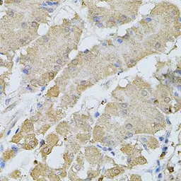 Anti-Bestrophin 1 antibody used in IHC (Paraffin sections) (IHC-P). GTX64583