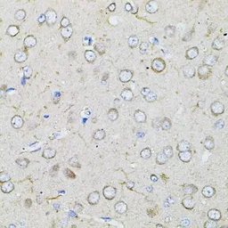 Anti-Bestrophin 1 antibody used in IHC (Paraffin sections) (IHC-P). GTX64583