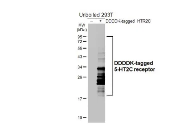 Anti-5-HT2C receptor antibody [HL5352] used in Western Blot (WB). GTX645830