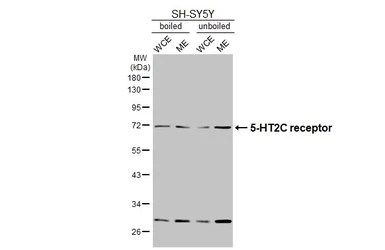Anti-5-HT2C receptor antibody [HL5352] used in Western Blot (WB). GTX645830