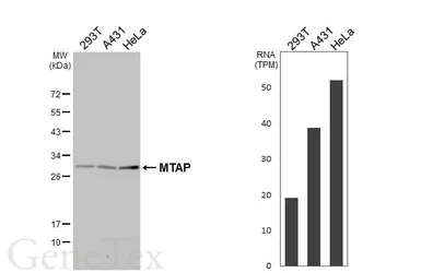 Anti-MTAP antibody [HL5358] used in Western Blot (WB). GTX645836