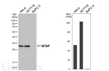 Anti-MTAP antibody [HL5358] used in Western Blot (WB). GTX645836
