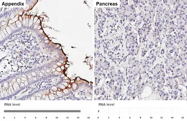 Anti-CEACAM1 antibody [HL5360] used in IHC (Paraffin sections) (IHC-P). GTX645838