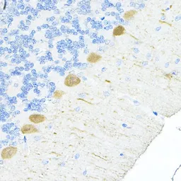 Anti-S100A6 antibody used in IHC (Paraffin sections) (IHC-P). GTX64584