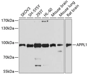 Anti-APPL1 antibody used in Western Blot (WB). GTX64585