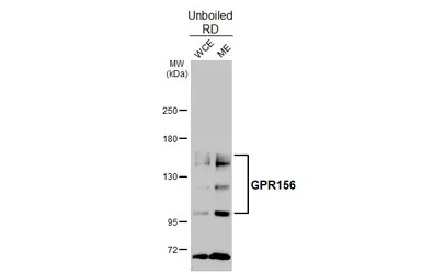 Anti-GPR156 antibody [HL5372] used in Western Blot (WB). GTX645850