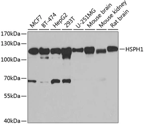Anti-HSP105 antibody used in Western Blot (WB). GTX64587