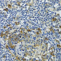 Anti-HSP105 antibody used in IHC (Paraffin sections) (IHC-P). GTX64587