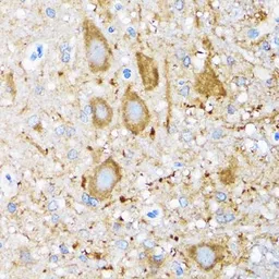 Anti-HSP105 antibody used in IHC (Paraffin sections) (IHC-P). GTX64587