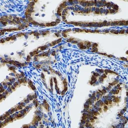 Anti-HSP105 antibody used in IHC (Paraffin sections) (IHC-P). GTX64587