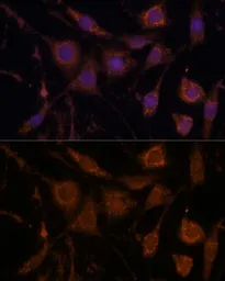 Anti-Stanniocalcin 1 antibody used in Immunocytochemistry/ Immunofluorescence (ICC/IF). GTX64588