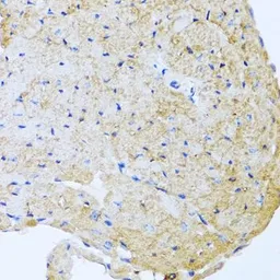 Anti-Stanniocalcin 1 antibody used in IHC (Paraffin sections) (IHC-P). GTX64588