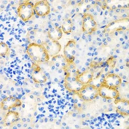 Anti-Stanniocalcin 1 antibody used in IHC (Paraffin sections) (IHC-P). GTX64588