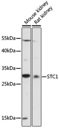 Anti-Stanniocalcin 1 antibody used in Western Blot (WB). GTX64588