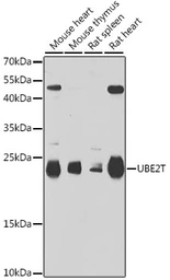 Anti-UBE2T antibody used in Western Blot (WB). GTX64589