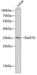 Anti-Rad51D antibody used in Western Blot (WB). GTX64591