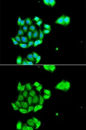 Anti-Rad51D antibody used in Immunocytochemistry/ Immunofluorescence (ICC/IF). GTX64591