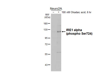 Anti-IRE1 alpha (phospho Ser724) antibody [HL5384] used in Western Blot (WB). GTX645952