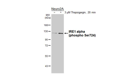 Anti-IRE1 alpha (phospho Ser724) antibody [HL5384] used in Western Blot (WB). GTX645952