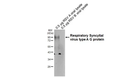 Anti-Respiratory Syncytial virus type A G protein antibody [HL5388] used in Western Blot (WB). GTX645956