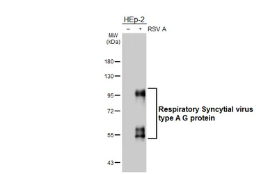 Anti-Respiratory Syncytial virus type A G protein antibody [HL5388] used in Western Blot (WB). GTX645956