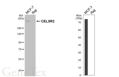 Anti-CELSR2 antibody [HL5390] used in Western Blot (WB). GTX645958