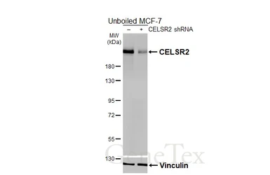 Anti-CELSR2 antibody [HL5390] used in Western Blot (WB). GTX645958