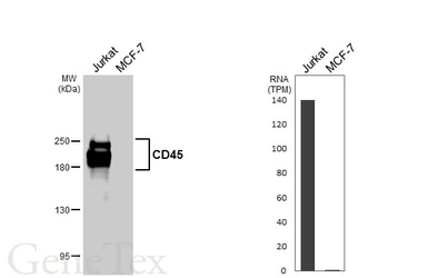 Anti-CD45 antibody [HL5393] used in Western Blot (WB). GTX645961