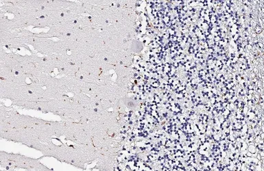 Anti-CD45 antibody [HL5393] used in IHC (Paraffin sections) (IHC-P). GTX645961