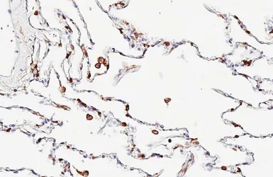 Anti-CD45 antibody [HL5393] used in IHC (Paraffin sections) (IHC-P). GTX645961