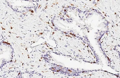 Anti-CD45 antibody [HL5393] used in IHC (Paraffin sections) (IHC-P). GTX645961