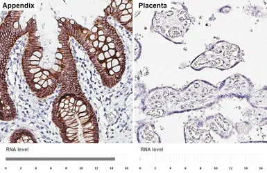 Anti-LI-Cadherin antibody [HL5394] used in IHC (Paraffin sections) (IHC-P). GTX645962