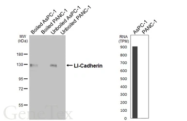 Anti-LI-Cadherin antibody [HL5395] used in Western Blot (WB). GTX645963