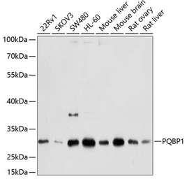 Anti-PQBP1 antibody used in Western Blot (WB). GTX64597