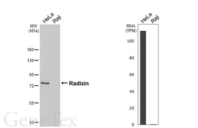 Anti-Radixin antibody [HL5402] used in Western Blot (WB). GTX645970