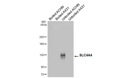 Anti-SLC4A4 antibody [HL5413] used in Western Blot (WB). GTX645981
