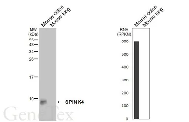 Anti-SPINK4 antibody [HL5418] used in Western Blot (WB). GTX645986