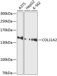 Anti-COL11A2 antibody used in Western Blot (WB). GTX64599