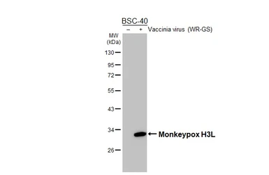 Anti-Mpox virus H3L antibody [HL5423] used in Western Blot (WB). GTX645991
