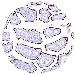 Anti-GPRC5A antibody [HMV4717] HistoMAX&trade; used in IHC (Paraffin sections) (IHC-P). GTX645997