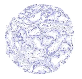 Anti-GFAP antibody [HMV4718] HistoMAX&trade; used in IHC (Paraffin sections) (IHC-P). GTX645998