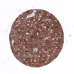 Anti-GFAP antibody [HMV4718] HistoMAX&trade; used in IHC (Paraffin sections) (IHC-P). GTX645998