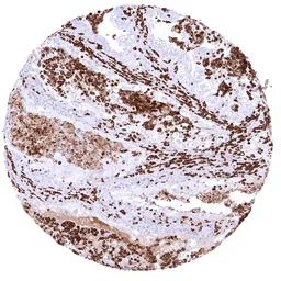 Anti-MMP9 antibody [HMV4720] HistoMAX&trade; used in IHC (Paraffin sections) (IHC-P). GTX646000