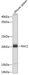 Anti-RAC2 antibody used in Western Blot (WB). GTX64601