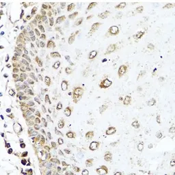 Anti-RAC2 antibody used in IHC (Paraffin sections) (IHC-P). GTX64601