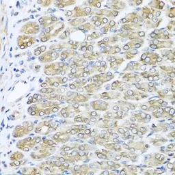 Anti-RAC2 antibody used in IHC (Paraffin sections) (IHC-P). GTX64601