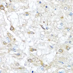 Anti-RAC2 antibody used in IHC (Paraffin sections) (IHC-P). GTX64601
